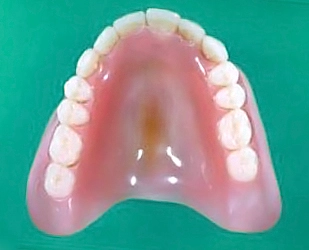 Acrylic Dental Polymers